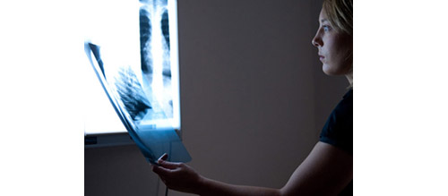 are-x-rays-harmful-inlign-osteopathy-south-yarra-pain-relief